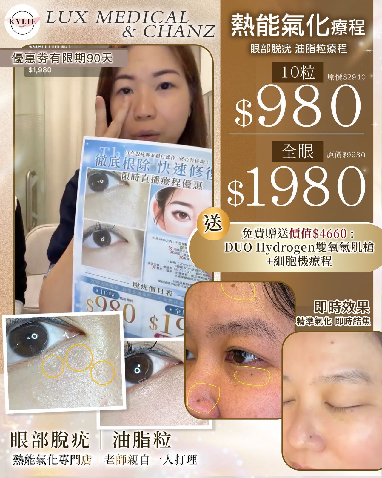 Lux Medical 2026 眼部脫疣