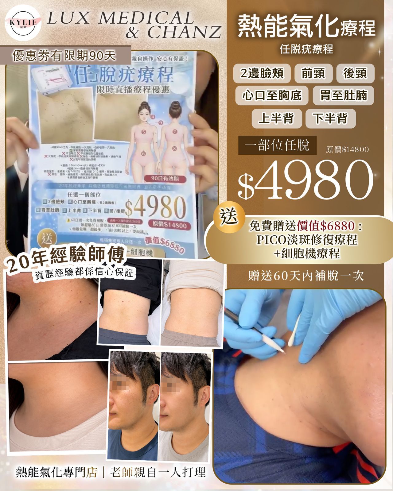 Lux Medical 2026 任脫疣療程