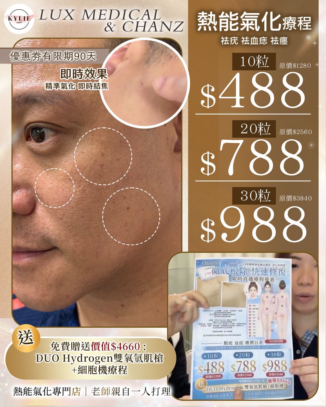 Lux Medical 2026 脫疣、血痣、墨療程