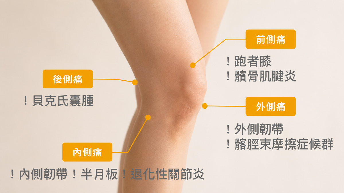 膝蓋疼痛位置分區圖