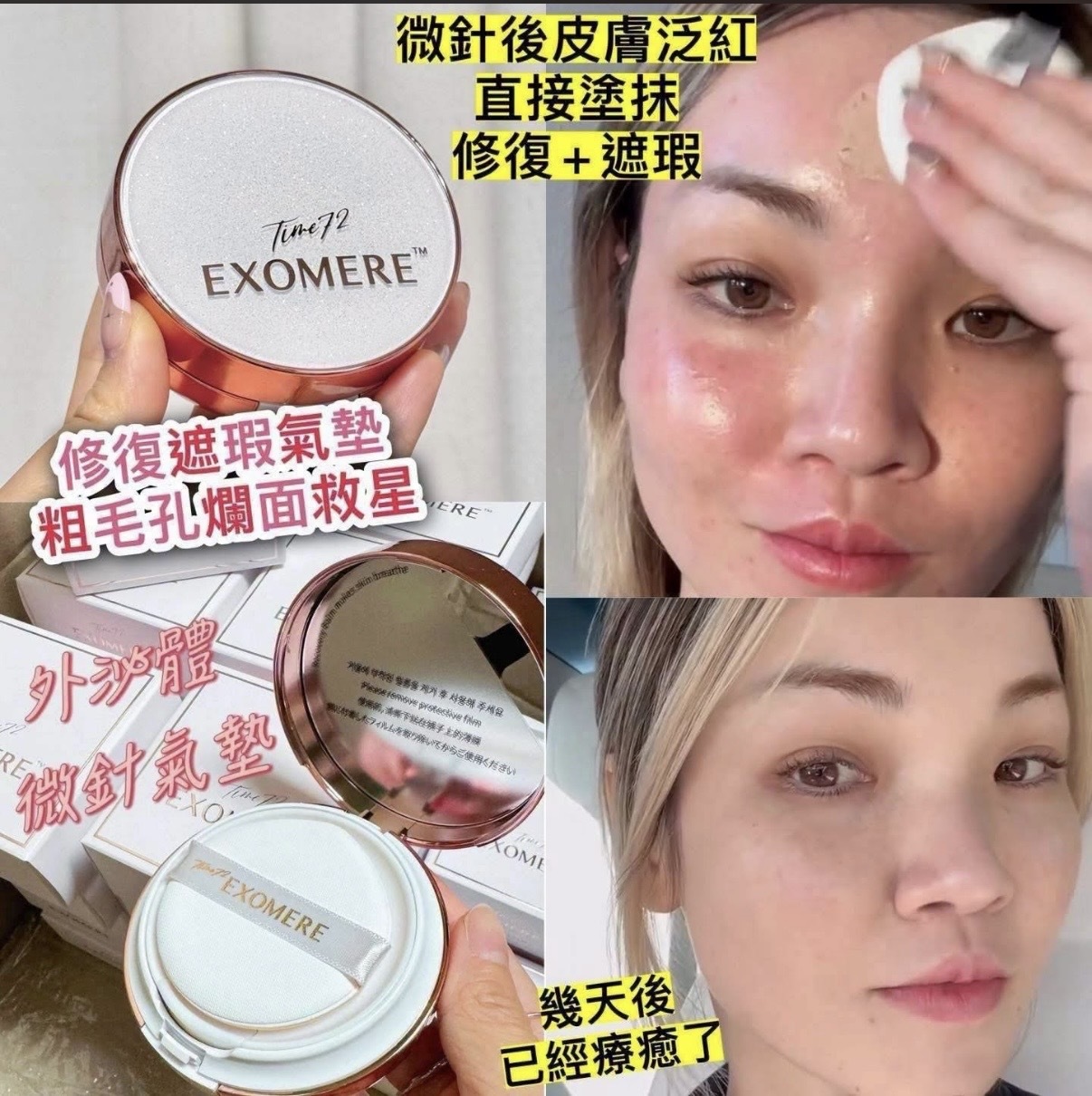 韓國Time 72 Exomere外泌體微針氣墊15g