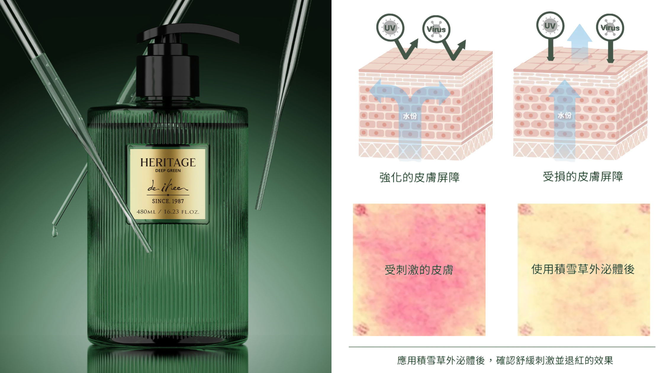 IHEE 積雪草洗髮精|頭皮抗老與控油舒緩大師
