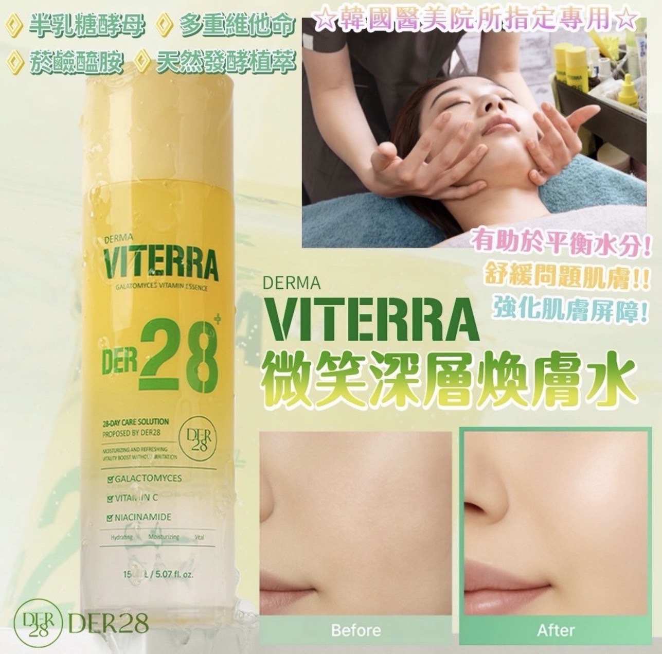 🇰🇷 韓國 SJ利特代言 DER28 VITERRA 微笑平衡修復水 150ml