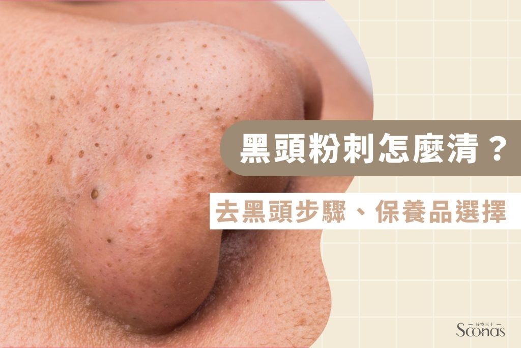 黑頭粉刺怎麼清2