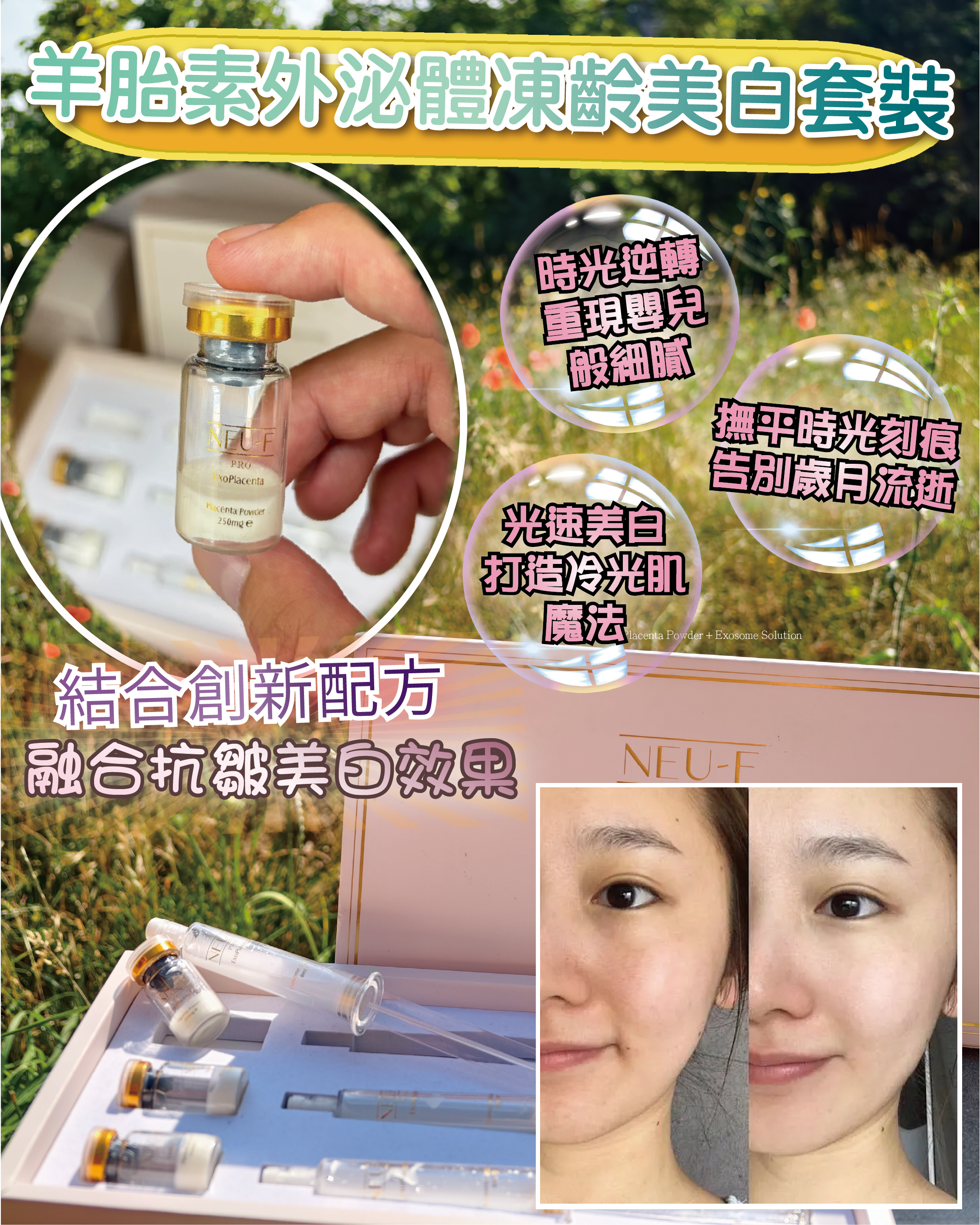 （預購）Neu-F Pro Revitalizing Placenta Powder + Exosome Solution 外泌體凍齡美白套裝（買一送一，共兩盒）