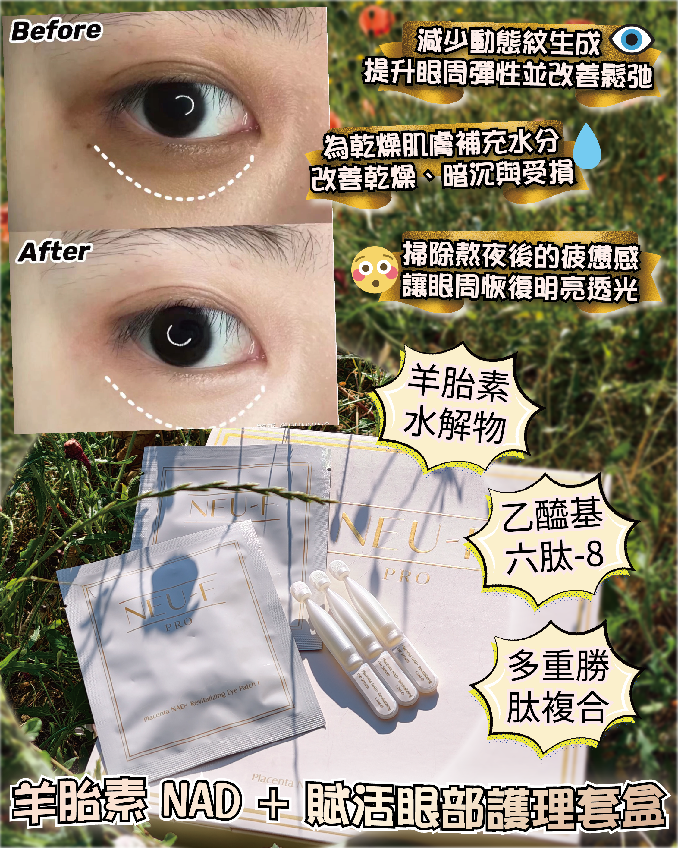 （預購）Neu-F Pro Placenta NAD + Revitalizing Eye Treatment 羊胎素再生活顏抗皺眼貼（買一送一，共兩盒）