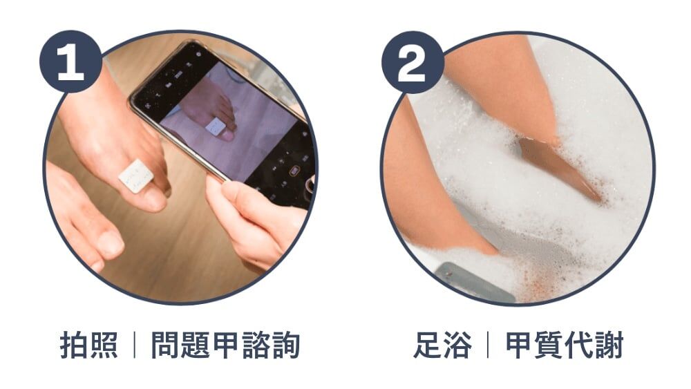 服務流程一：拍照，問題甲諮詢。服務流程二：足浴以促進甲質代謝