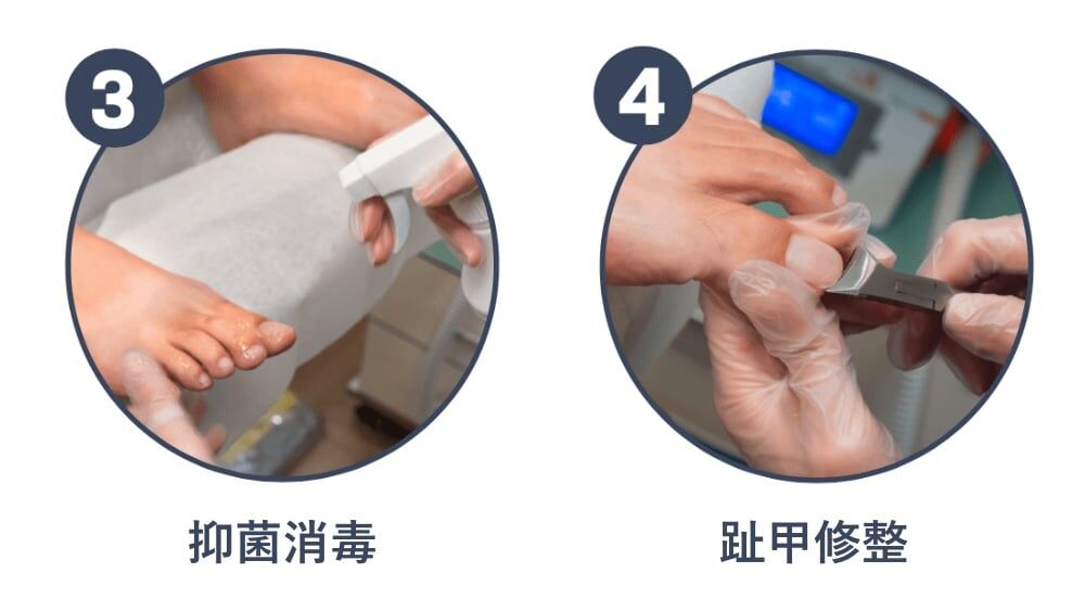 服務流程三：抑菌消毒。服務流程四：趾甲修整