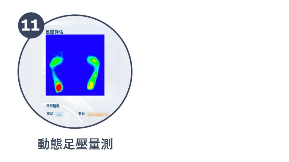 服務流程十一：動態足壓量測，了解自己是否有扁平足和拇趾外翻，扁平足和拇趾外翻容易導致嵌甲