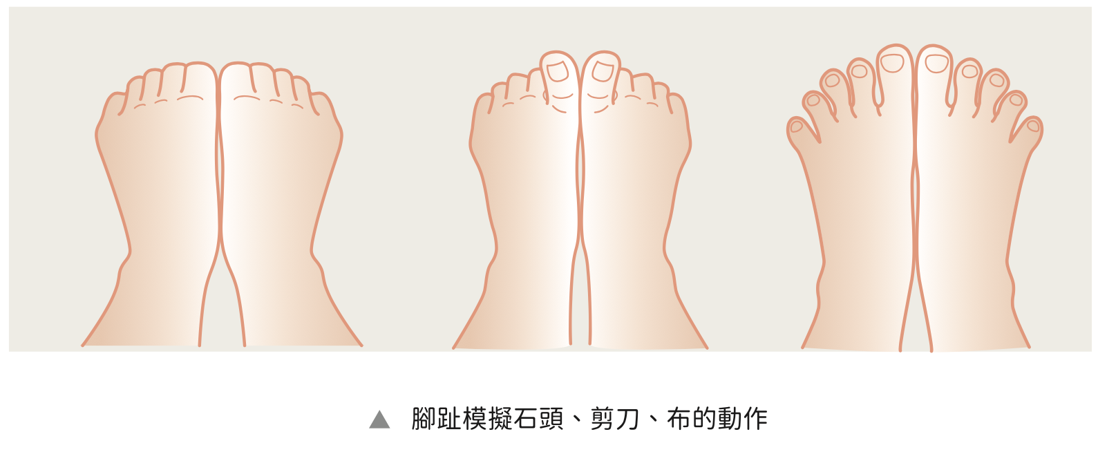 拇指外翻診斷與預防︱陳建宏醫師