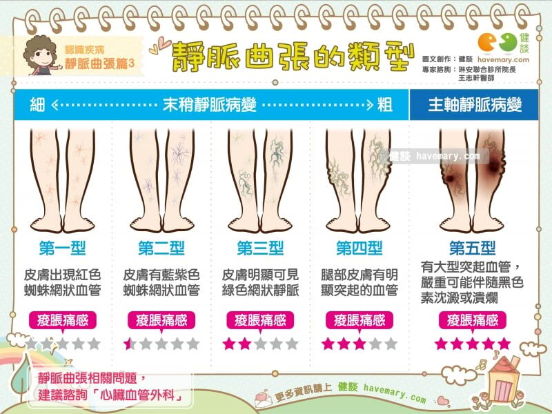 攀附下肢的藍色蜘蛛網|王志軒醫師