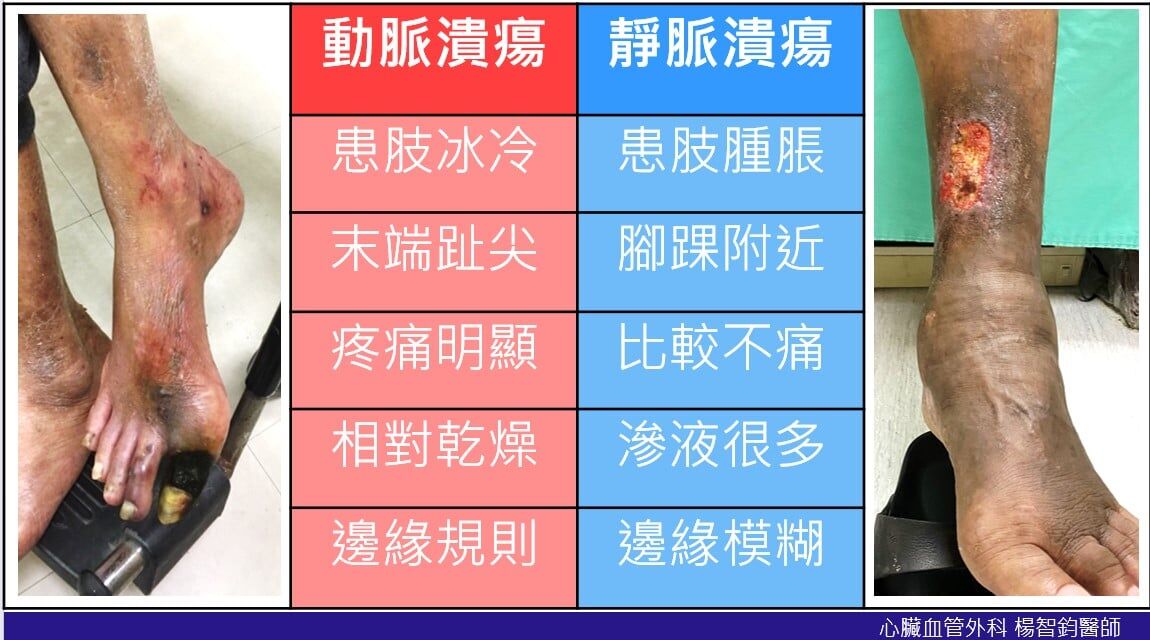 你所不知道的足循環健康|楊智鈞醫師