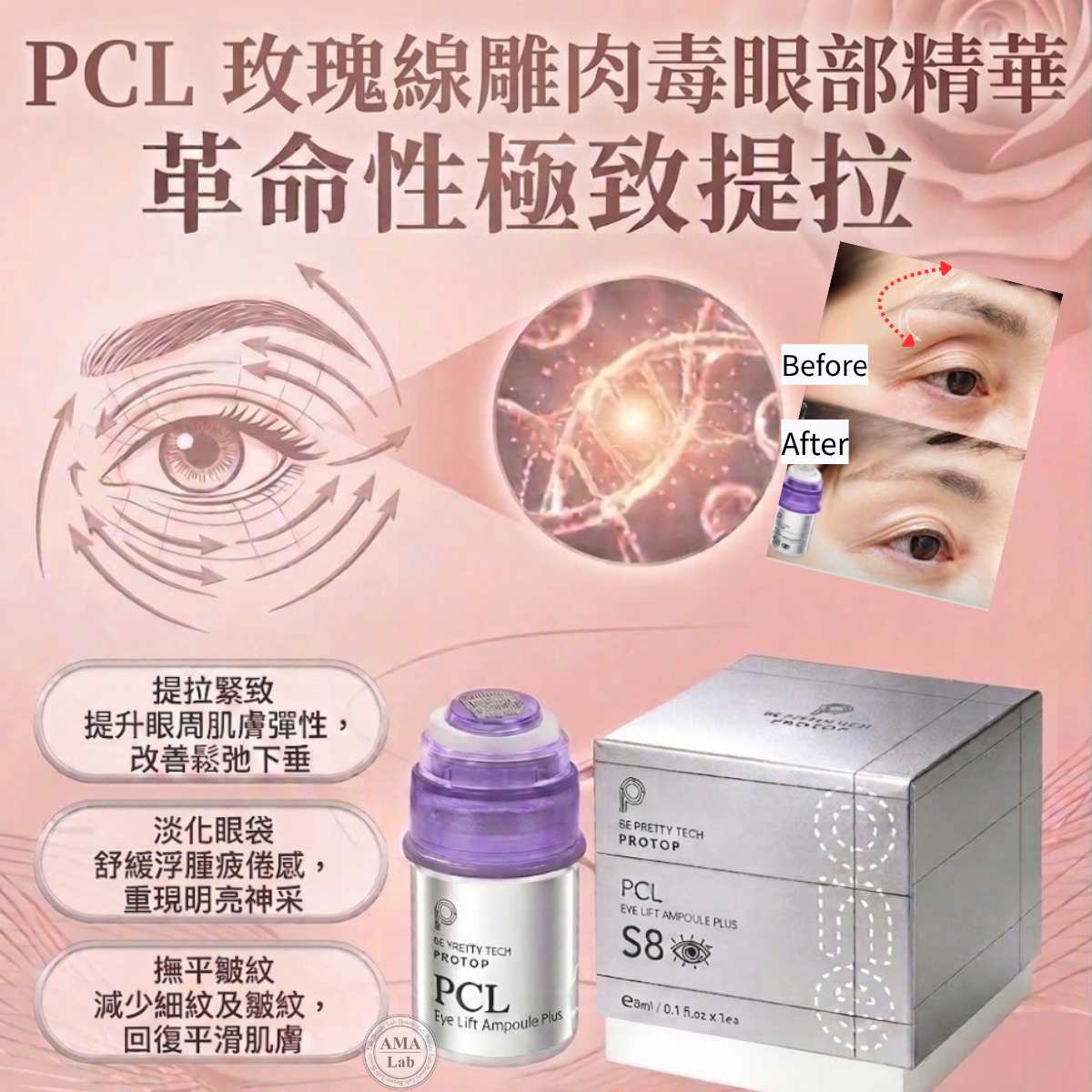 PROTOP PCL S8埋線眼