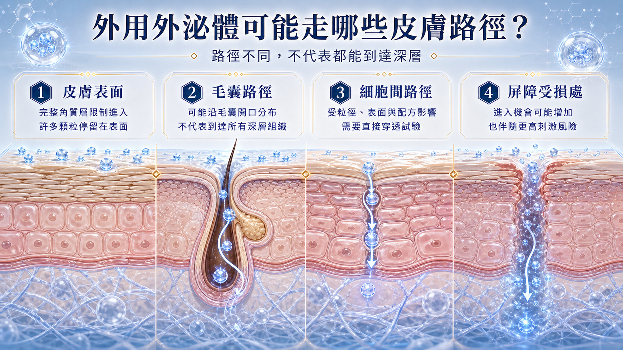外用外泌體四種皮膚路徑,包括皮膚表面、毛囊、細胞間與屏障受損處。