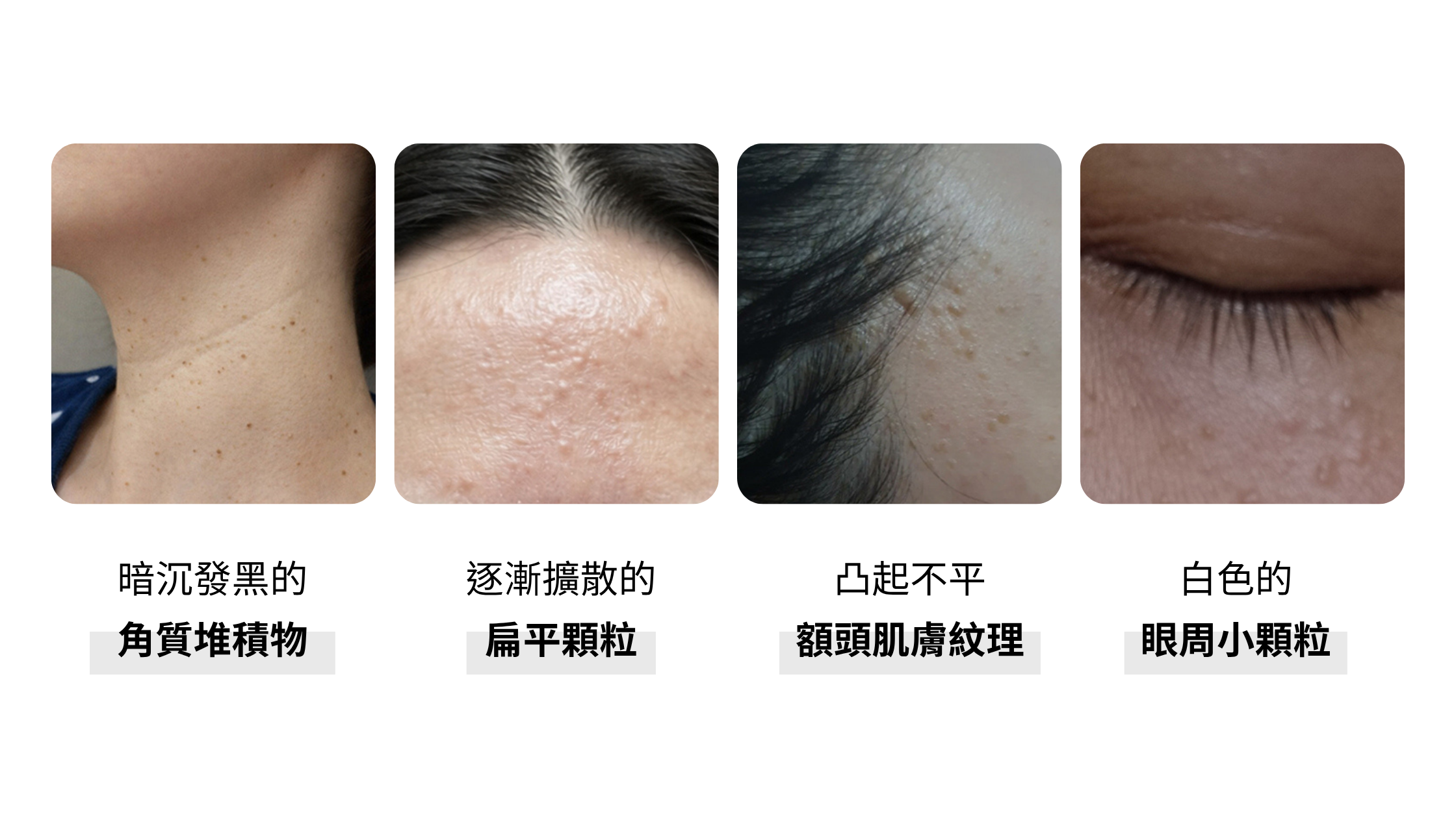 為什麼臉上總是摸起來有「粗糙顆粒感」?