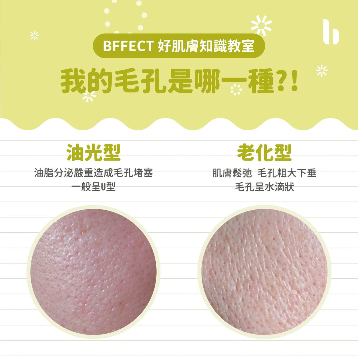 【BFFECT小教室】我的毛孔是哪一種??