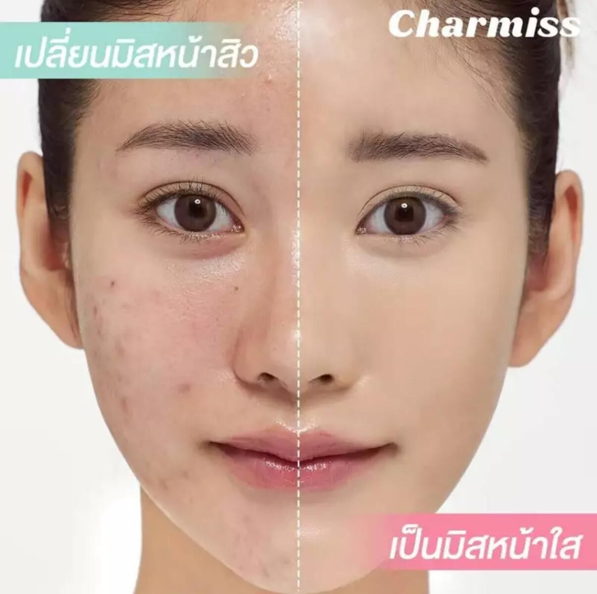 泰國 Charmiss 零瑕疵暗瘡肌專用霧面氣墊 SPF50+ PA++++