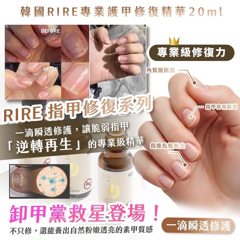 韓國製造卸甲救星RIRE專業護甲修復精華20ml