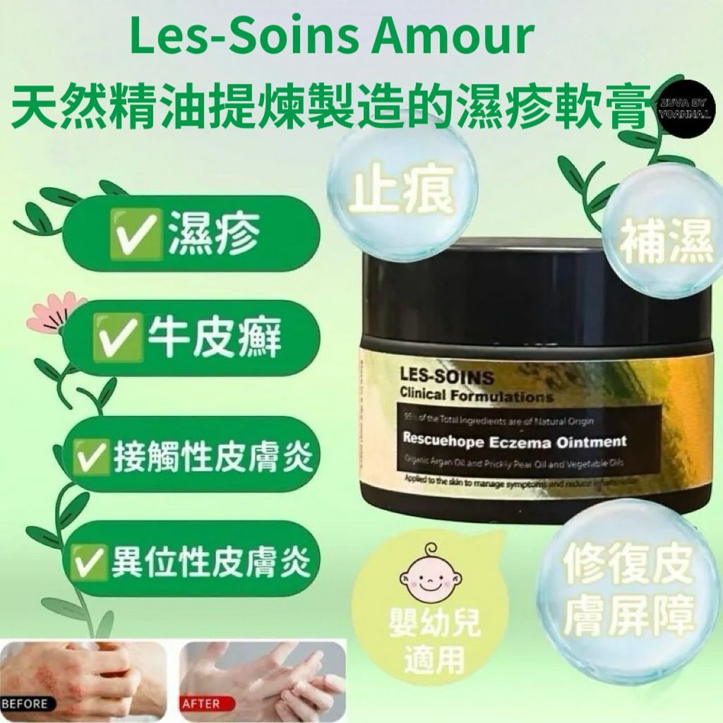 R284 Les-soins 天然精油提煉製造的濕疹軟膏50ml ( 主婦手、痤瘡、牛皮癬、濕疹、暗瘡、任何皮膚敏感均適用）