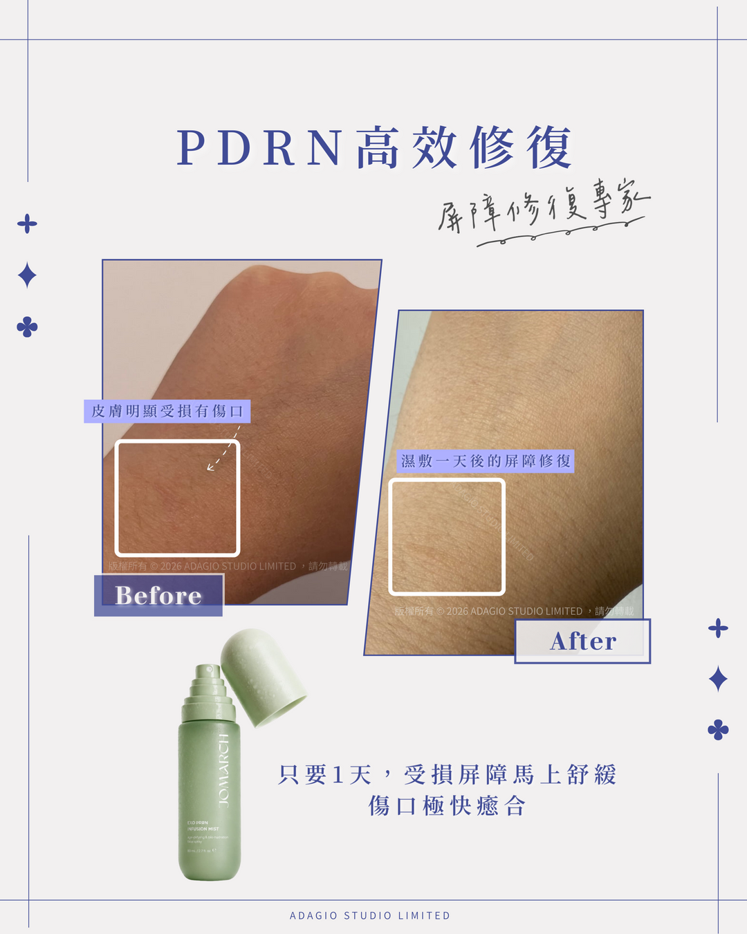 PDRN 修復噴霧 80ml