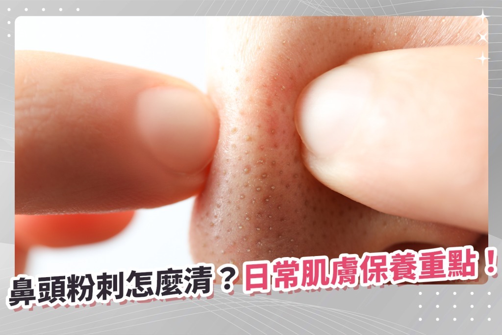 鼻頭粉刺怎麼清?