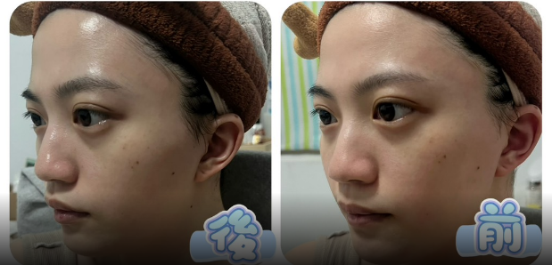 京站店旻筠 肌秘磁導面膜真實使用回饋