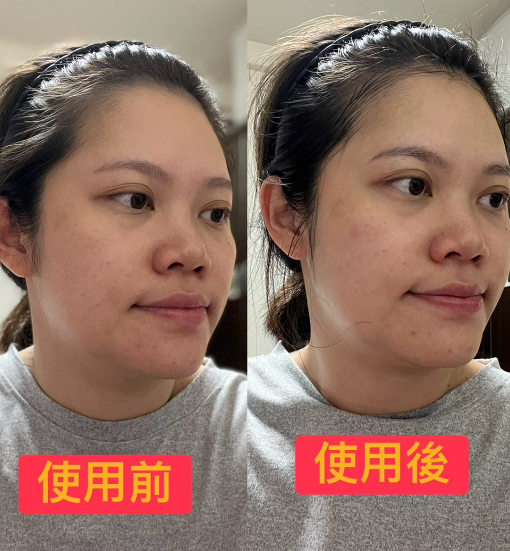 中山店佳榛 肌秘磁導面膜真實使用回饋