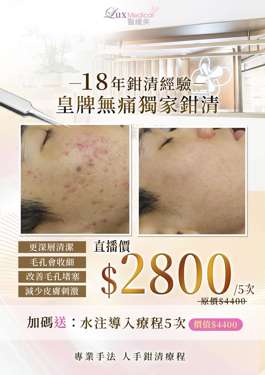 B5 Lux Medical 醫纖美皇牌無痛獨家鉗清 送 水注導入療程 5次 (HK$2800/5次)【新/舊客可買】