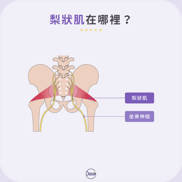 梨狀肌位置