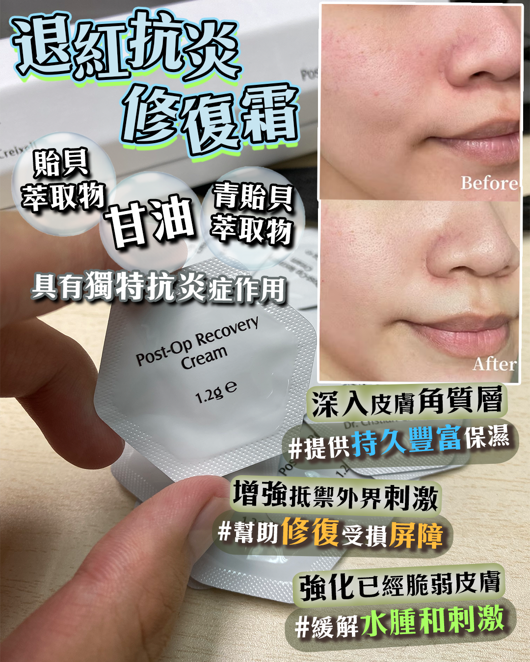 20260907_ Neu-F Pro Post - Op Recovery Serum 14pcs