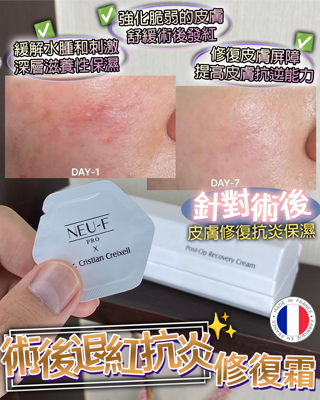 20260907_ Neu-F Pro Post - Op Recovery Cream 14pcs