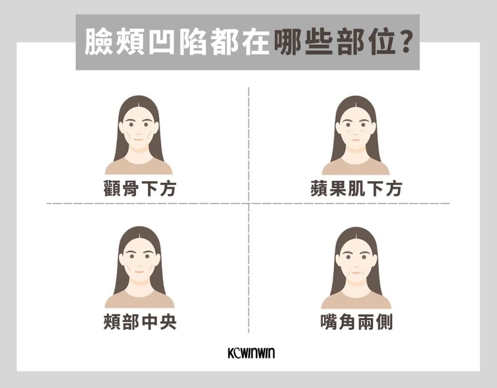 臉頰凹陷都在哪些部位
