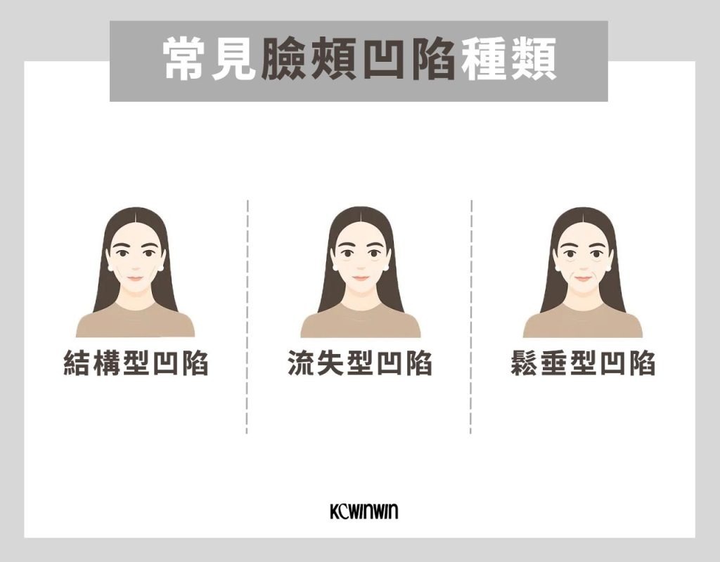 常見臉頰凹陷種類