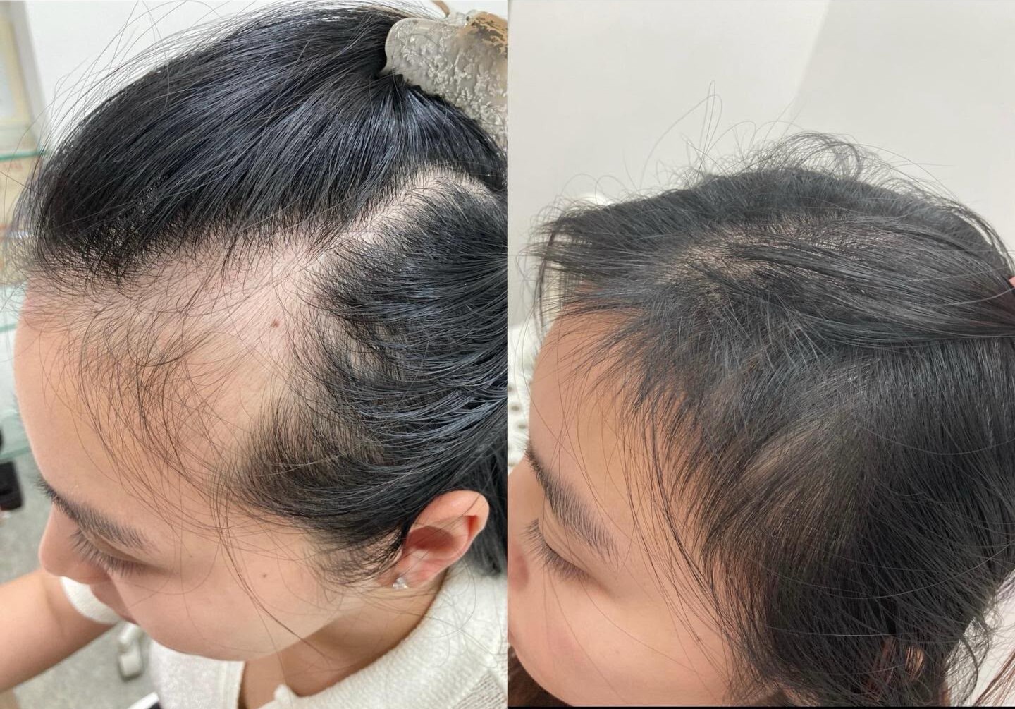 0922NH04-NOBEL-HAIR-髮之生長因子2.0 (1倍濃縮度) 30ml/支 [買3送1 平均$598.5／支] (A4)