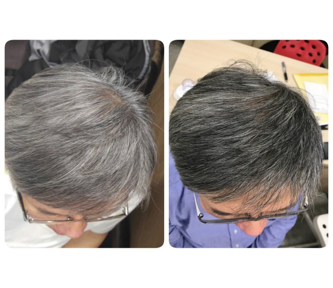 0922NH06-NOBEL-HAIR-髮之亮黑因子 30ml/支 [買3送1 平均$748.5／支] (A6)