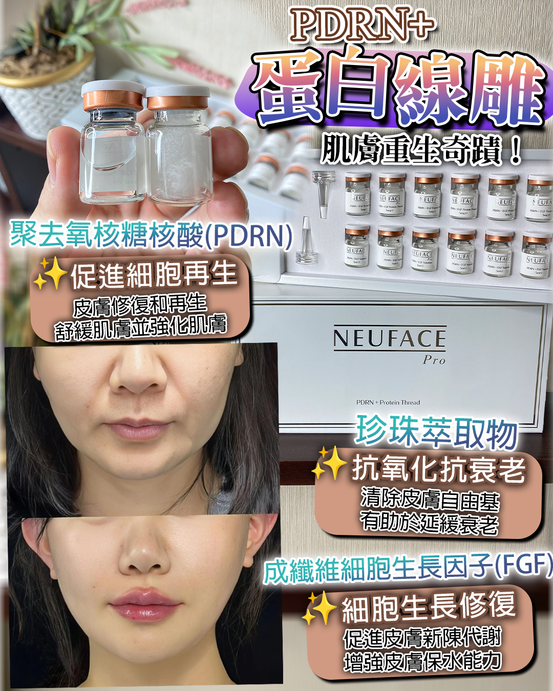 Neuface pro PDRN + Protein Thread PDRN+蛋白線雕 12對（展覽會簡裝無盒 ）