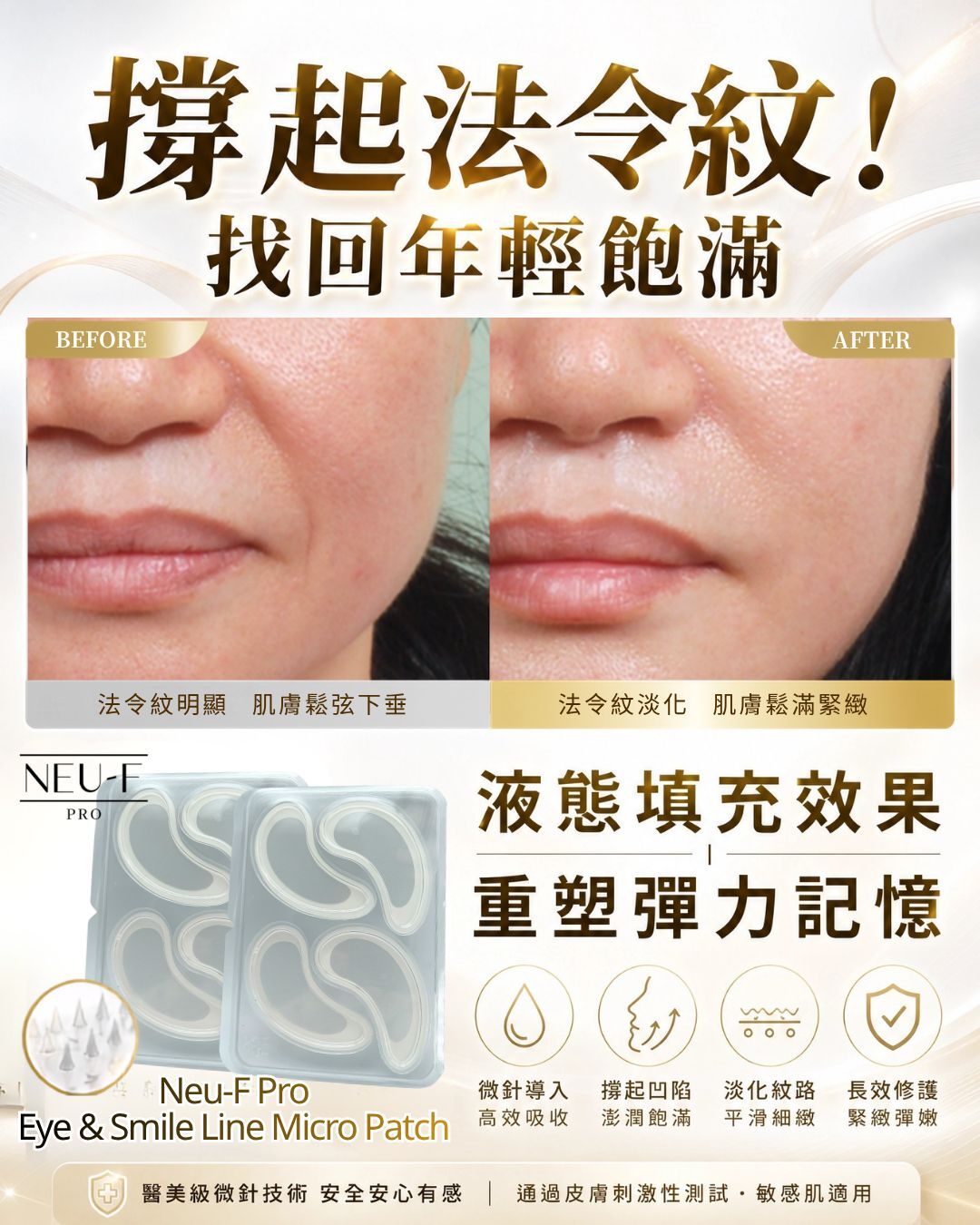 Neu-F Pro Eye & Smile Line Micro Patch