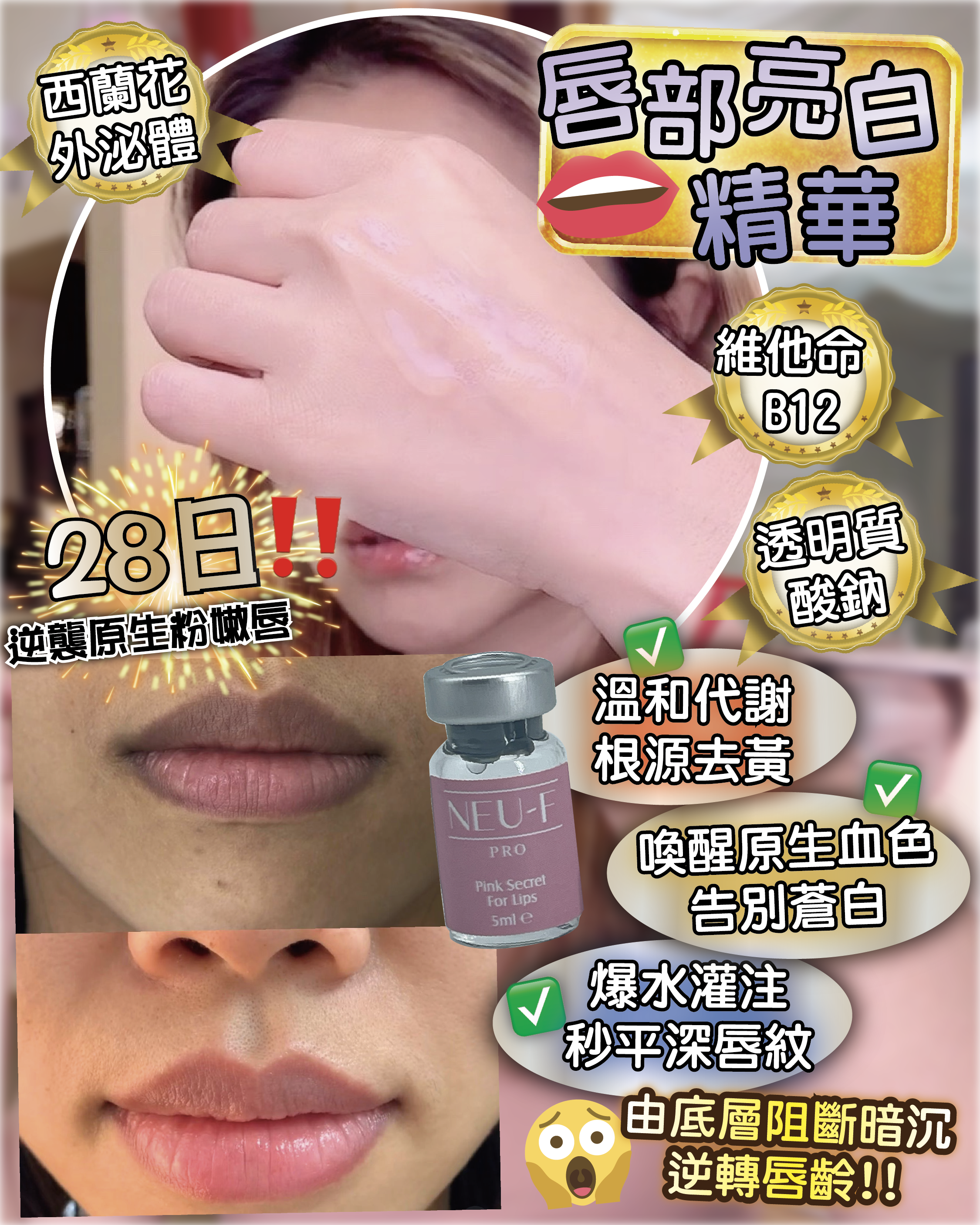 （預購）Neu-F Pro Pink Secret For Lip 5ml