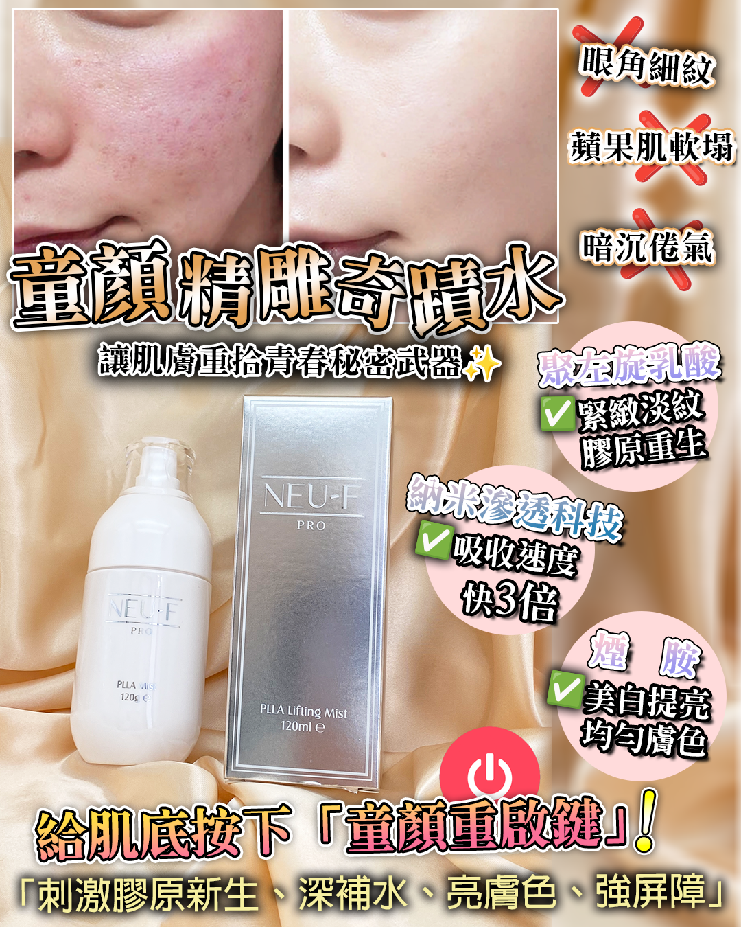 Neu-F Pro PLLA Lifting Mist