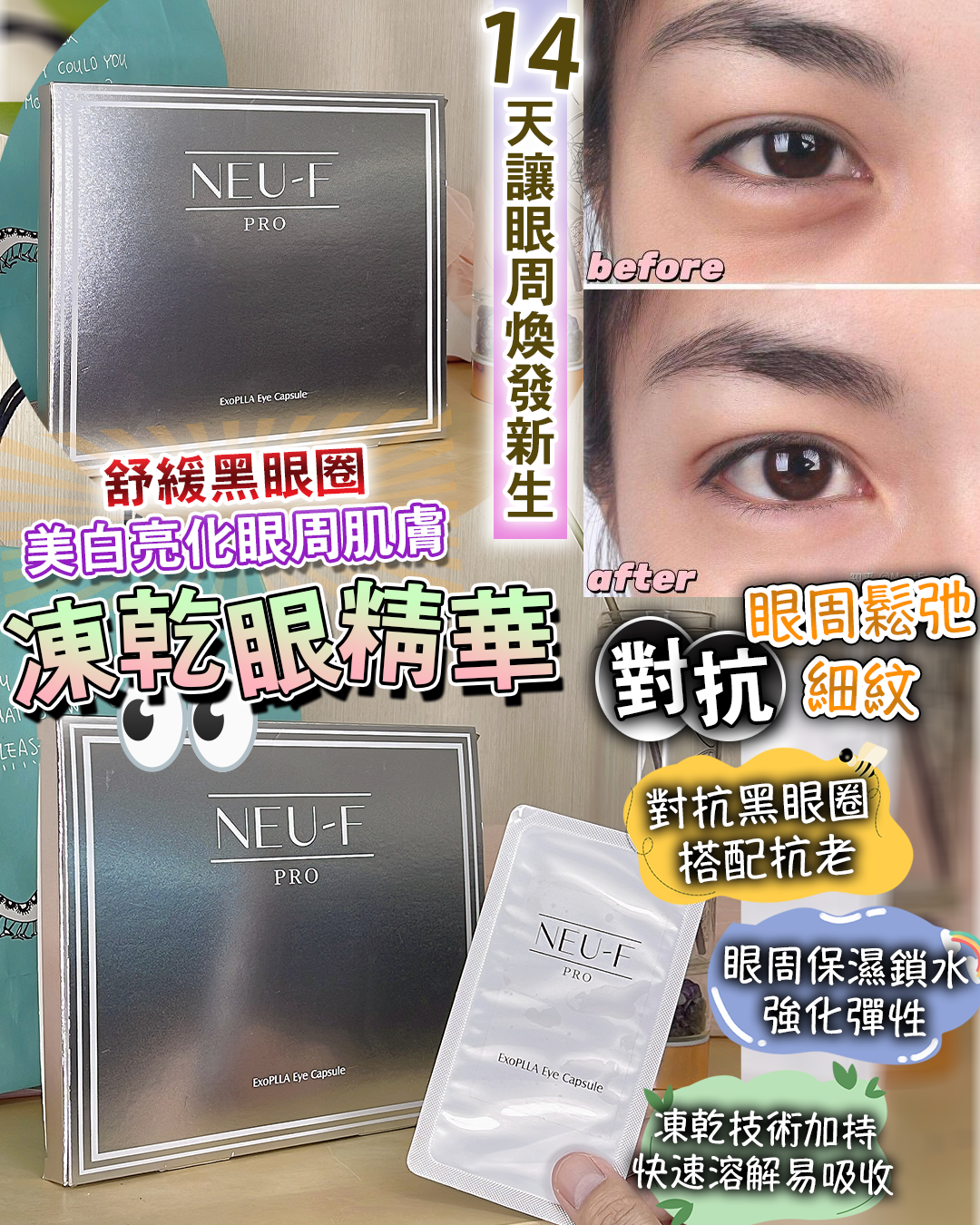 Neu - F Pro Exo PLLA Eye Capsule