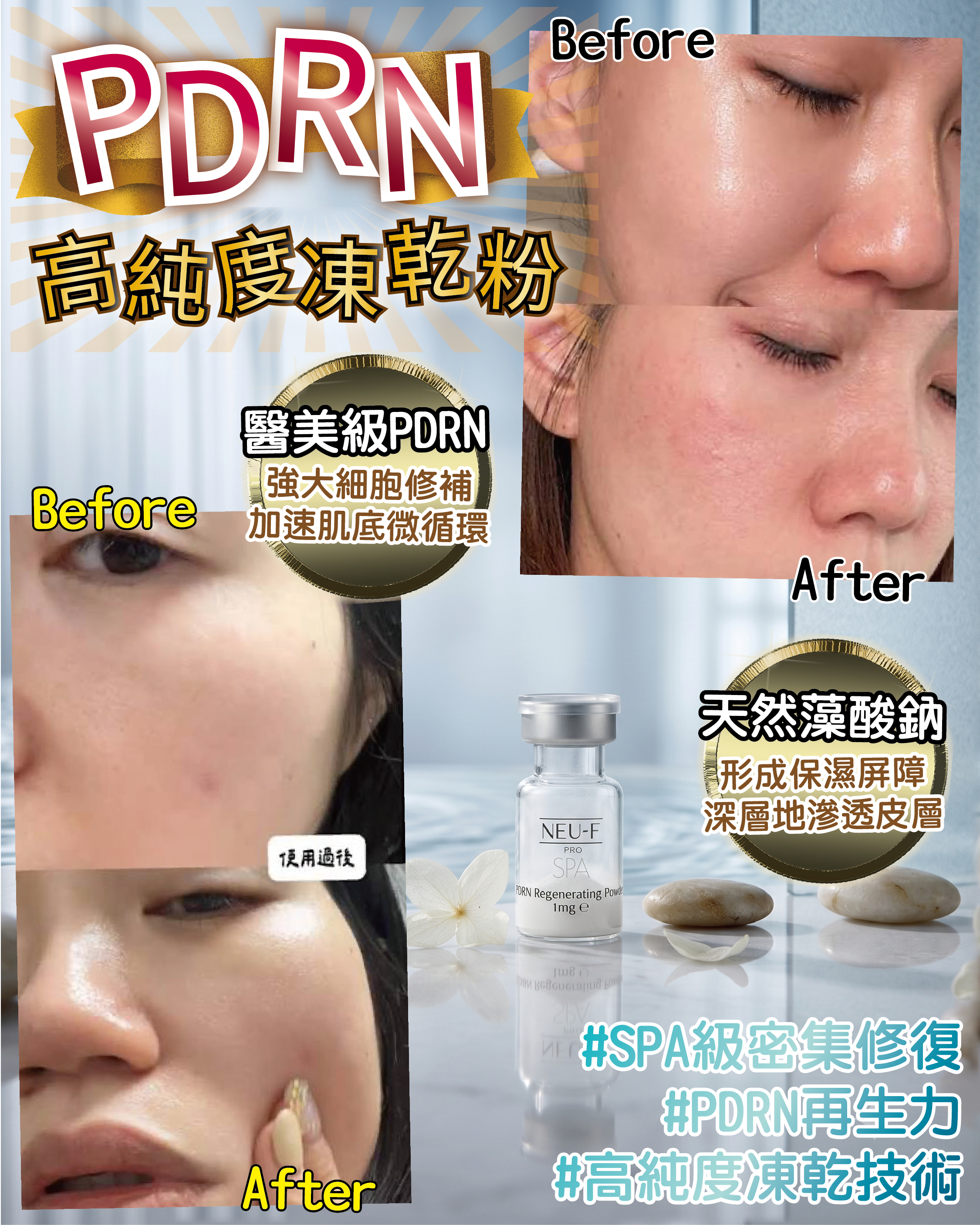 （預購）Neu-F Pro SPA PDRN Regenerating Powder