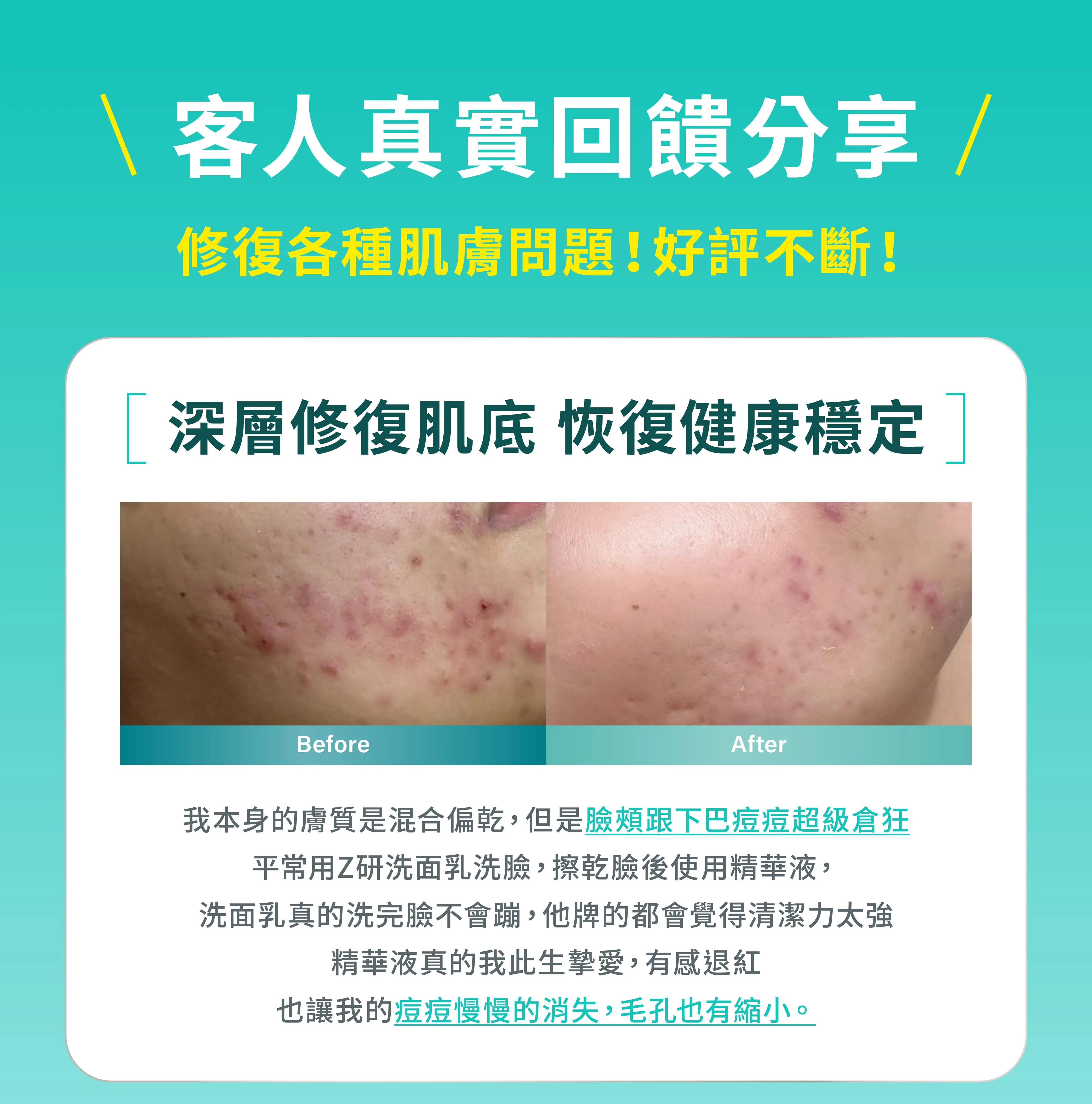 Z研植物科學保養,全系列深層修復、穩定肌膚狀況