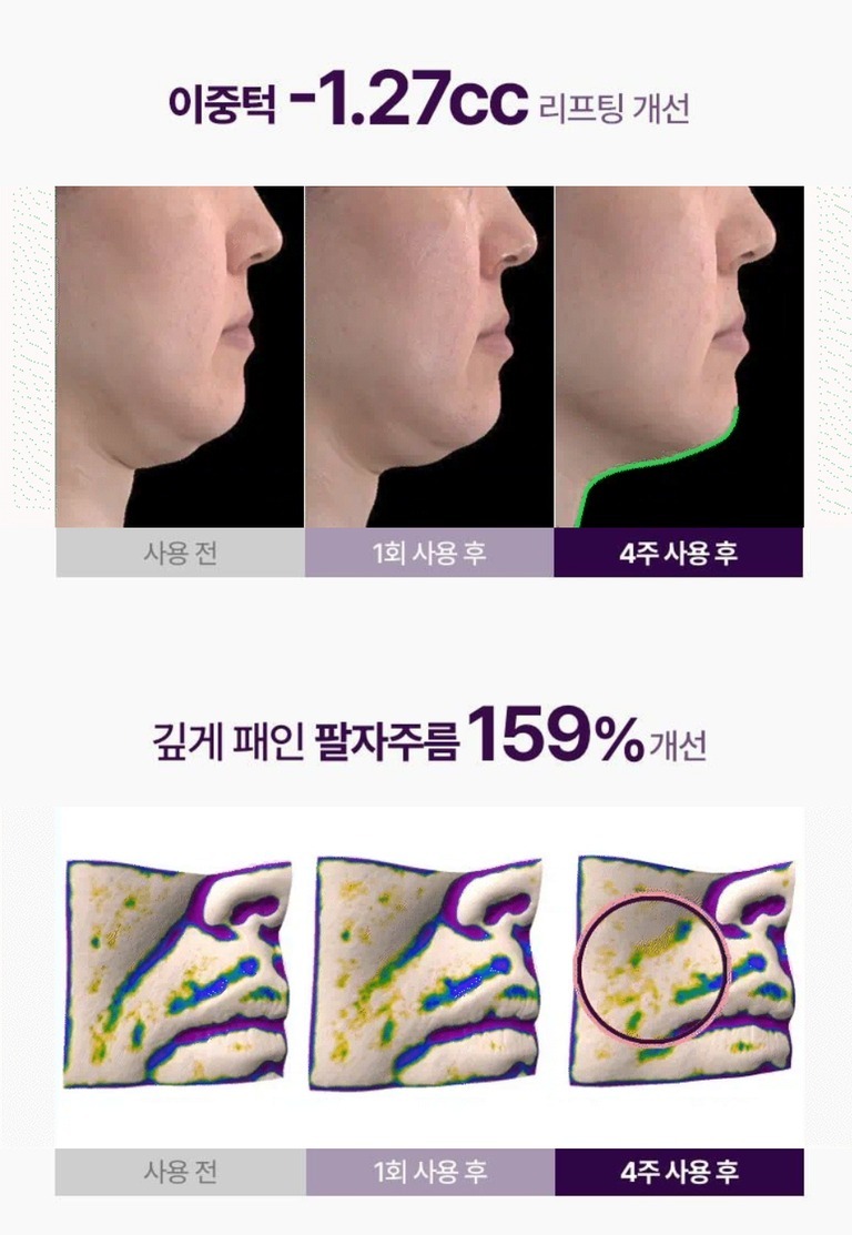 韓國 MEDITHERAPY V臉塑顏 緊緻面膜T547  5片/盒