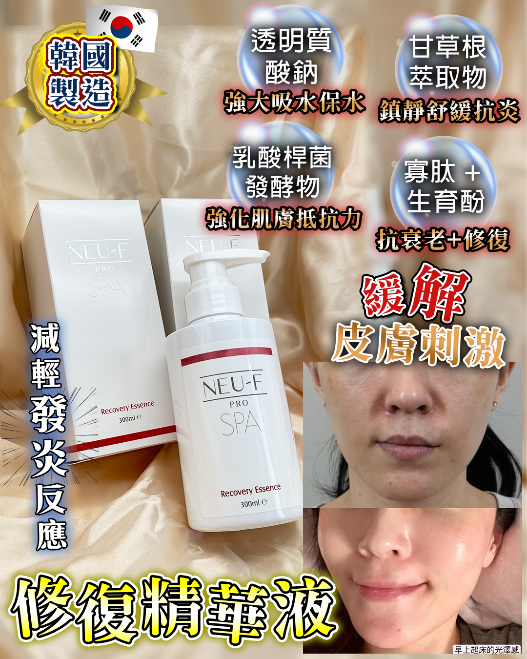 Neu-F Pro SPA Recovery Essence  修復精華液300ml（買一送一，共兩支）