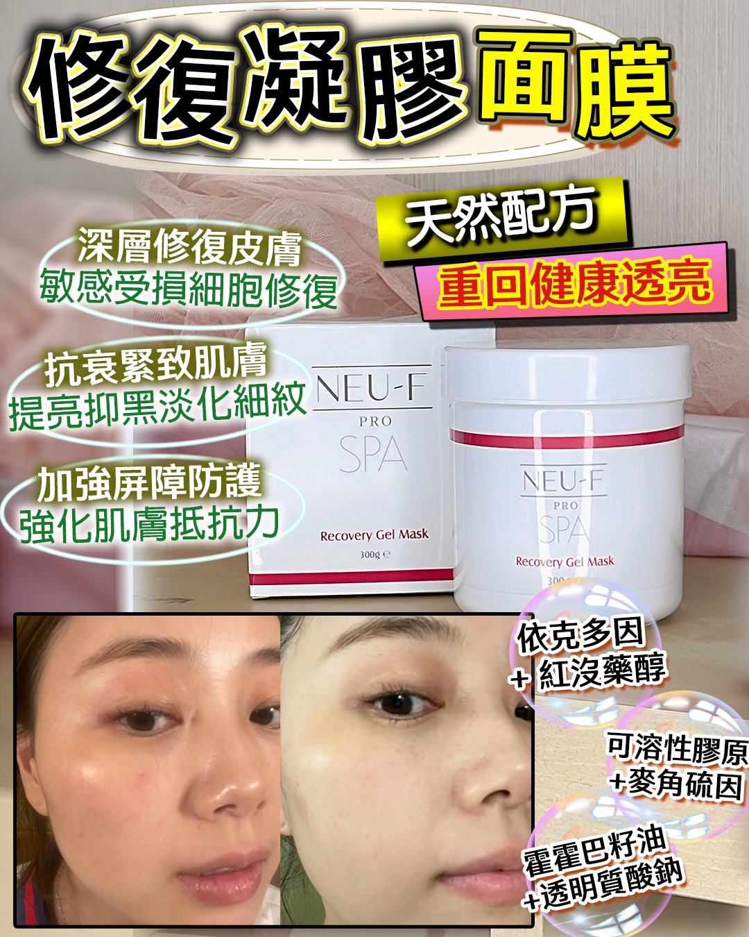 Neu-F Pro SPA Recovery Gel Mask 修復凝膠面膜300g （買一送一，共兩支）