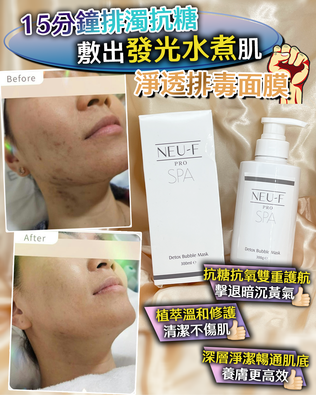 Neu-F Pro SPA Detox Bubble Mask 淨透排毒面膜 300ml（買一送一，共兩支）