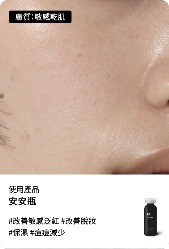 Be友分享圖片 3，安安瓶