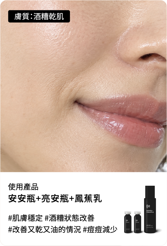 Be友分享圖片 7，密集調理安定組