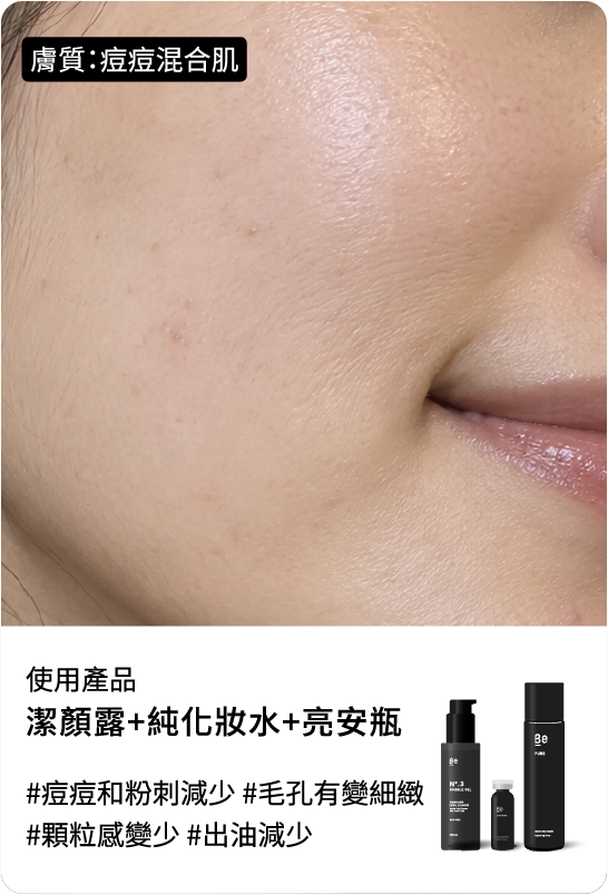 Be友分享圖片 10，乾肌保養組