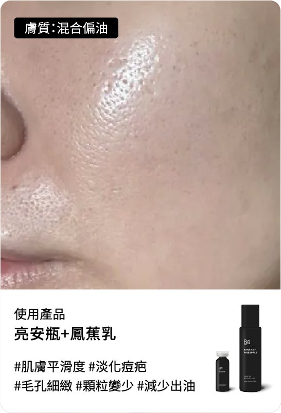 Be友分享圖片 1，油水平衡組